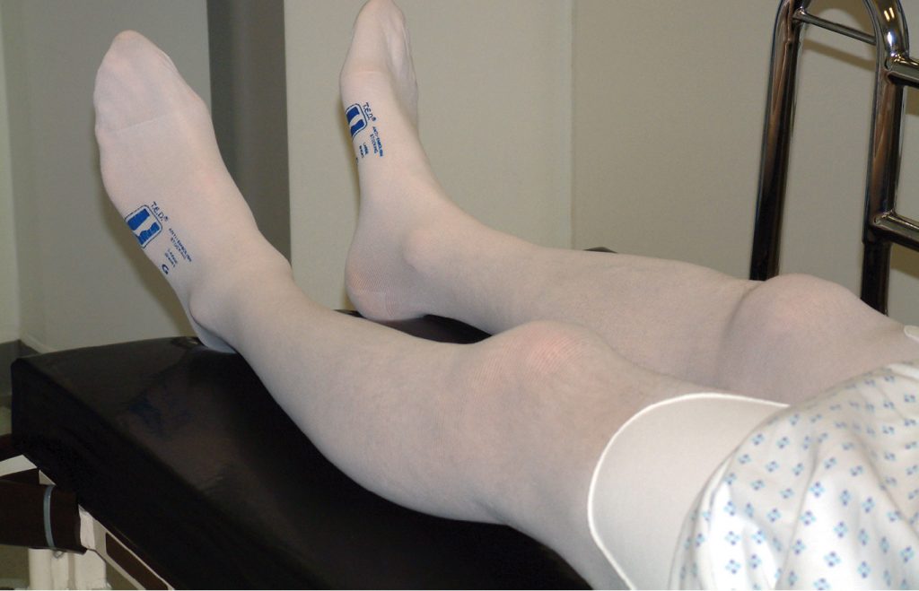 Surgical patients' adherence to the use of compression stockings 